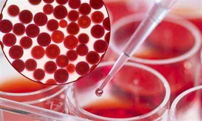 Astaxanthin
